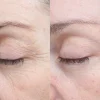 Bioeffect 30 day treatment tehohoito 3 kpl