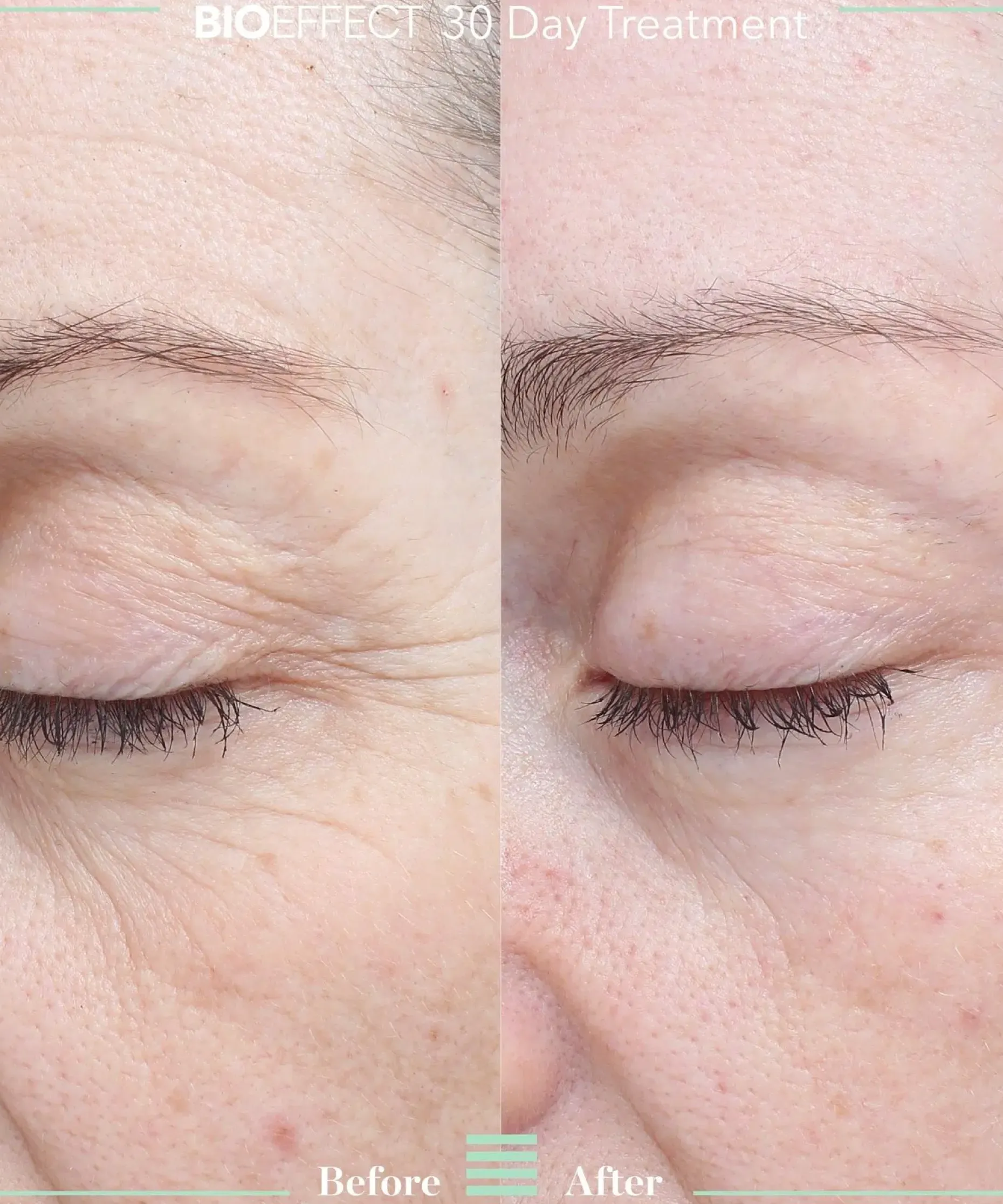 Bioeffect 30 day treatment tehohoito 3 kpl