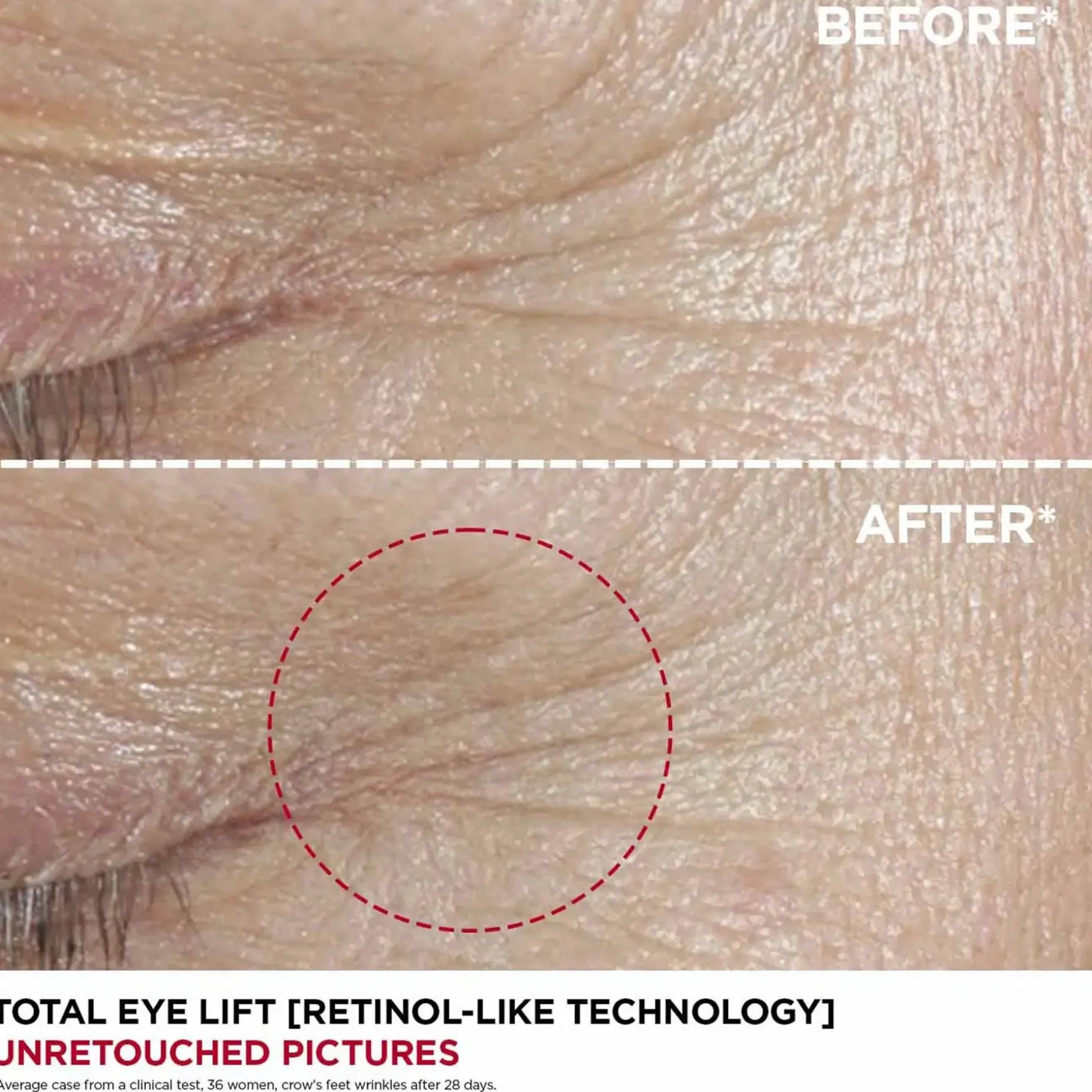 Clarins Total eye lift silmänympärysvoide täyttöpakkaus 15ml
