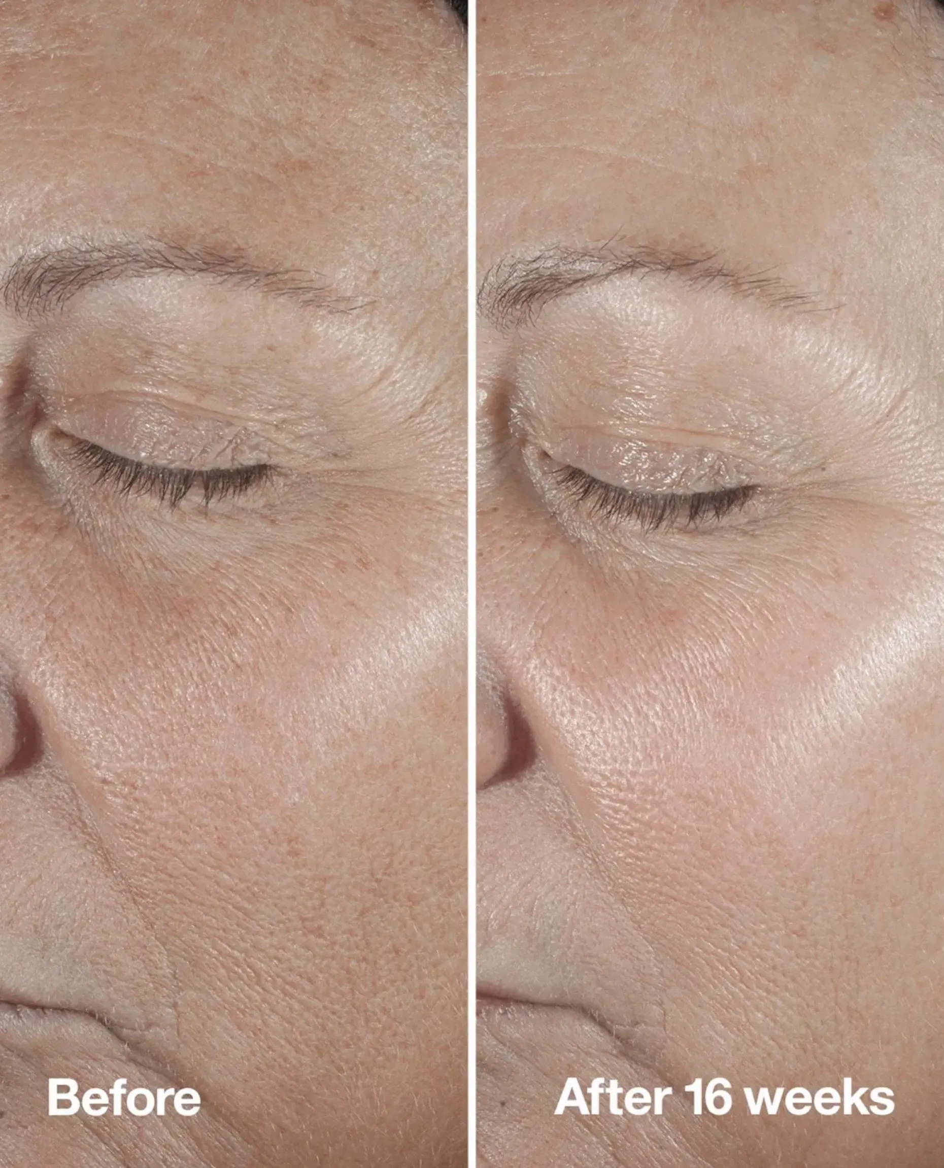 Clinique Smart Clinical Repair Seerumi 30 ml