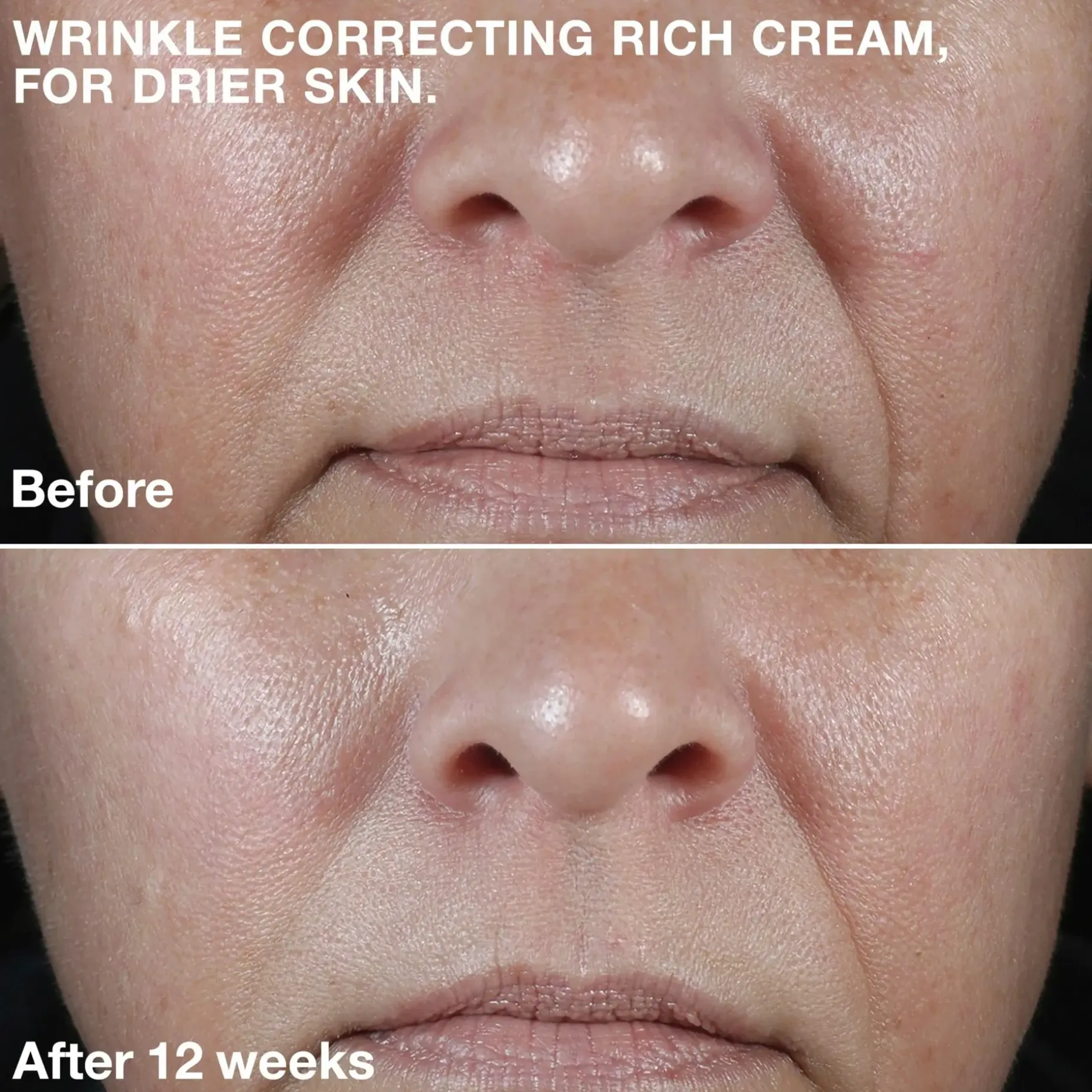 Clinique Smart Clinical Repair Wrinkle Correcting Rich Cream kosteusvoide 50 ml