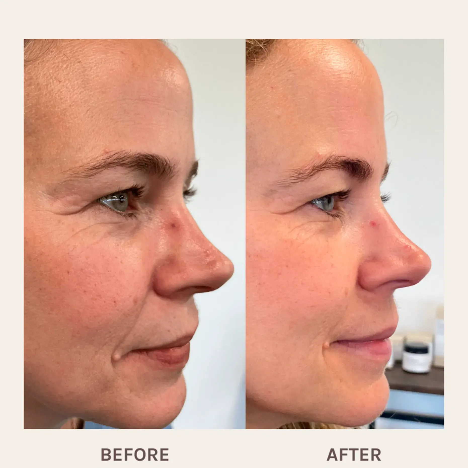 Evolve Organic Beauty Age Defying Lifting kasvoseerumi 30ml