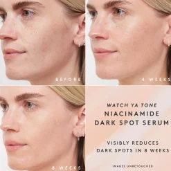 Fenty Skin Watch Ya Tone Niacinamide Dark Spot Seerumi 30 ml