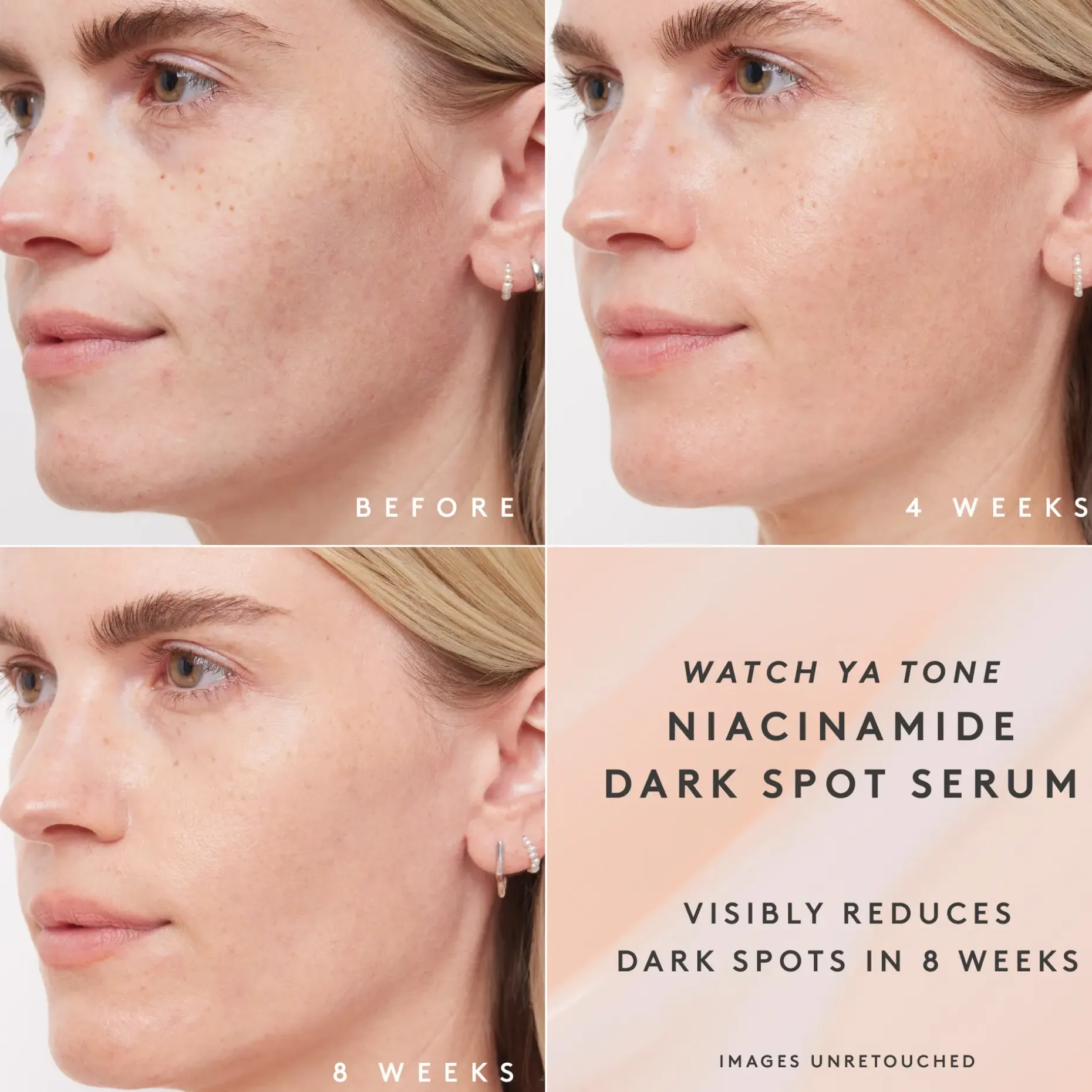 Fenty Skin Watch Ya Tone Niacinamide Dark Spot Seerumi 30 ml
