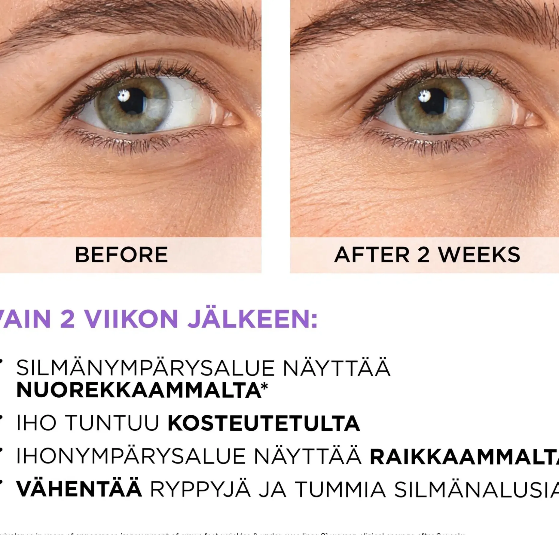 L'Oréal Paris Revitalift Filler 2,5% Hyaluronic Acid + Caffein Eye Serum silmänympärysalueelle 20 ml